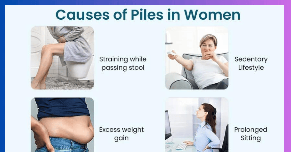 Piles In Women 6 Causes Symptoms Pictures And Best Treatments 3672